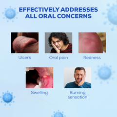 Ulsor Mouth Gel